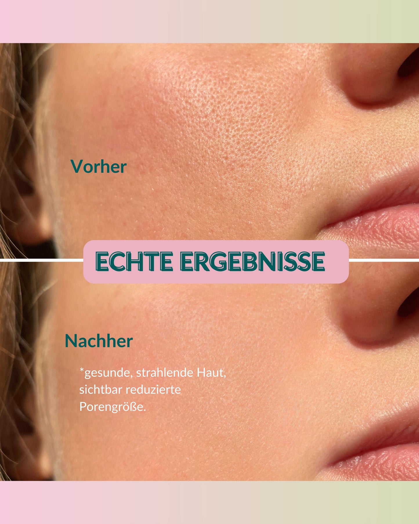 set de limpieza facial