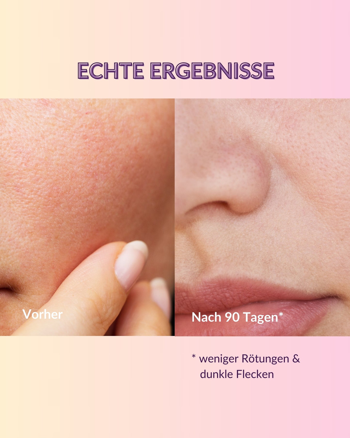 Sérum Vitamine C BIO