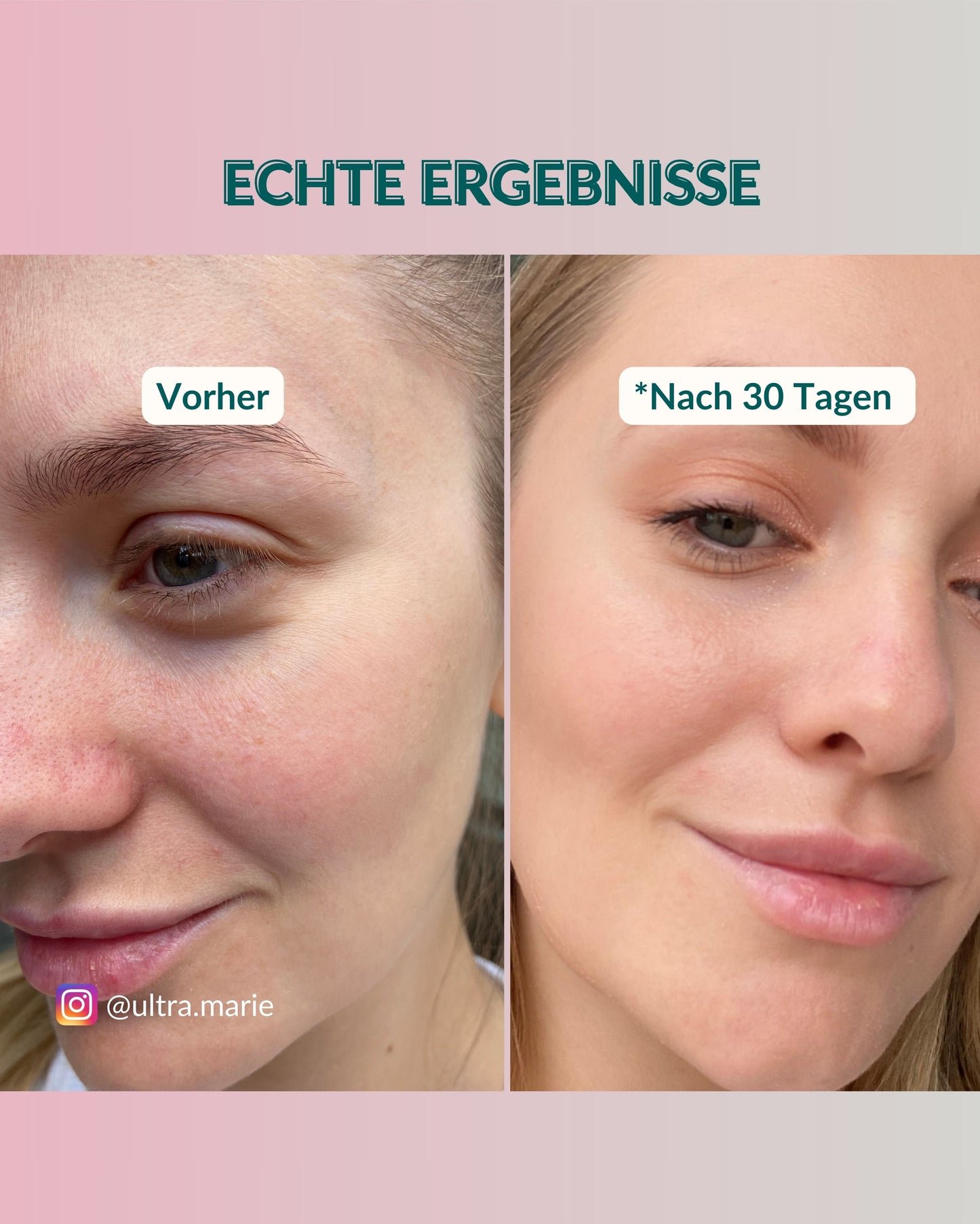 Gesichtsreiniger = Waschgel zur Gesichtsreinigung Pretty clear - Face Tonic (mit Bio-Aloe)
