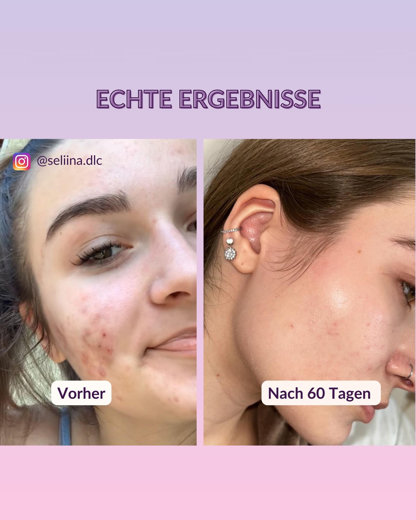 Masque de boue de la Mer Morte