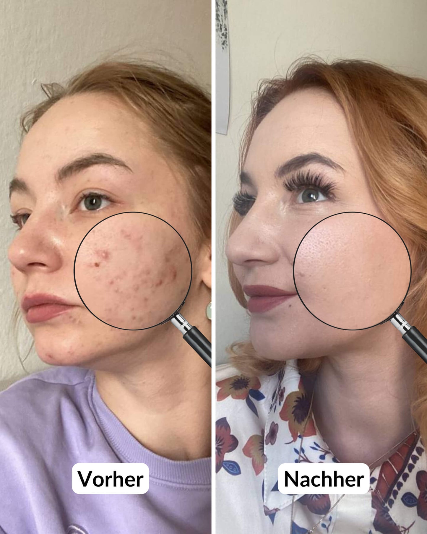 Hidratante BIO-Retinol