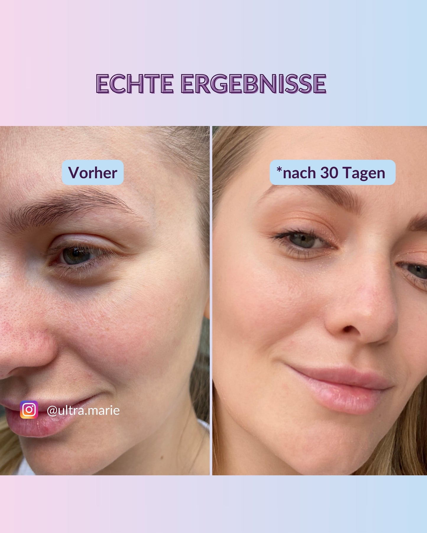 Sérum Acide Hyaluronique