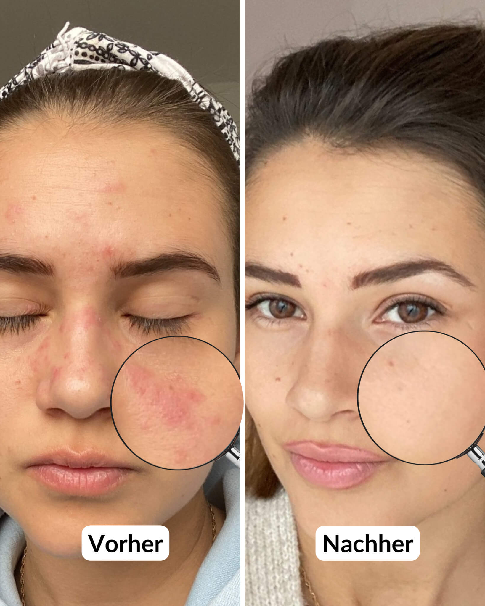 Mioxbel Retinol Serum 4% Verkapselt – Anti-Aging Für Straffe Haut, Gegen Falten & Flecken